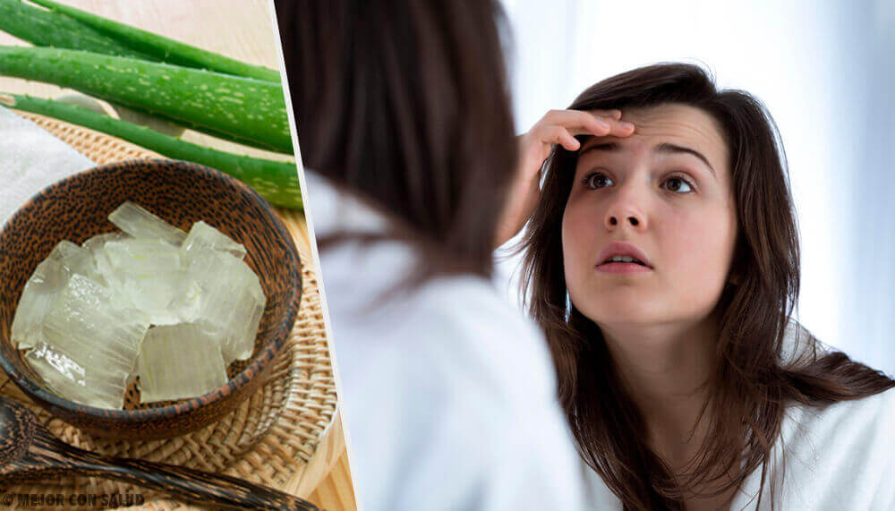 Slik kan du redusere rynker med aloe vera Slik kan du redusere rynker med aloe vera