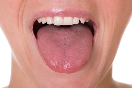 De 5 første symptomene på tungekreft