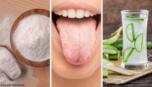 Det hvite belegget på tungen: 8 naturlige remedier