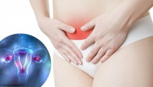 Symptomer på endometriose du bør kjenne til