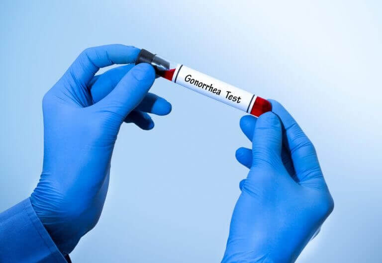 Blodprøve for gonoré