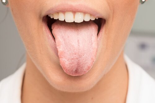Bli kvitt det hvite belegget på tungen