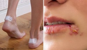 5 tips for å lege og bli kvitt blemmer