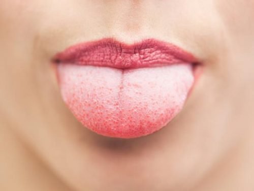 Rengjør tungen din
