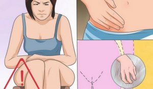 Soppinfeksjon i skjeden: Årsaker, symptomer og behandling