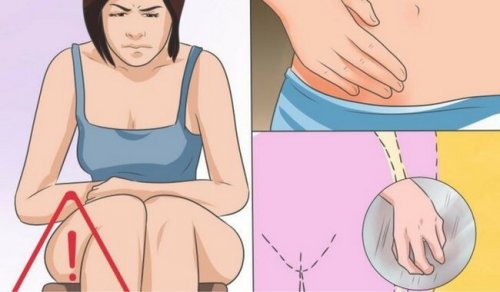 Soppinfeksjon i skjeden: Årsaker, symptomer og behandling