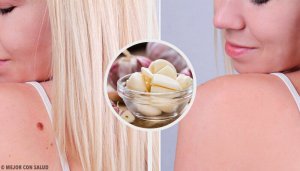 9 naturlige tips for å fjerne vorter raskt