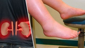 Hva er det som forårsaker vann i kroppen?