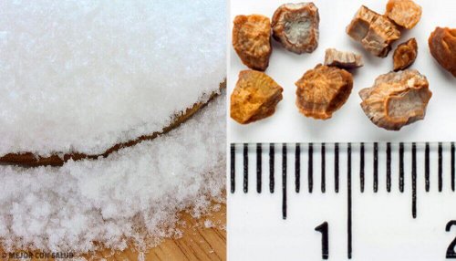 Midler mot nyrestein