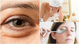 6 naturlige tips for å redusere poser under øynene