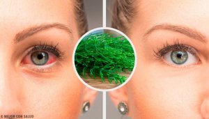 7 anbefalinger for å bekjempe øyekatarr naturlig