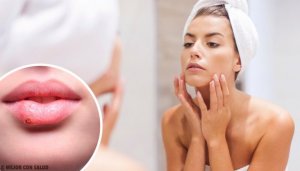 13 tegn på ansiktet ditt som kan indikere et helseproblem