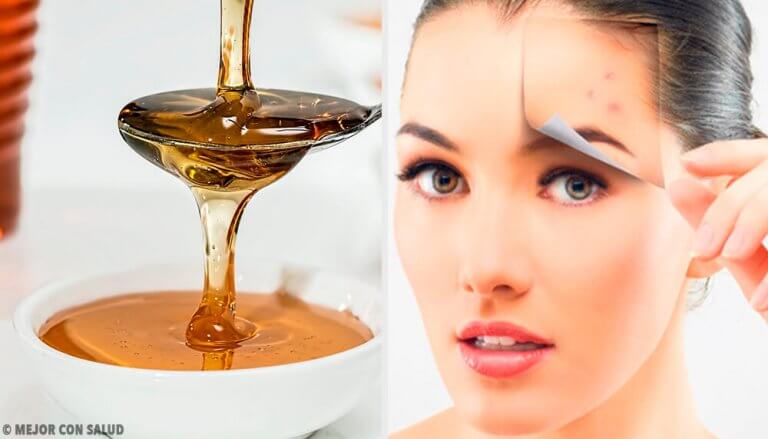 4 naturlige oppskrifter for sunn hud