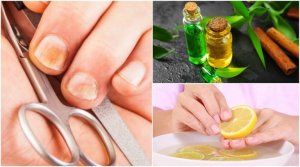 5 triks for å eliminere neglesopp og styrke neglene dine