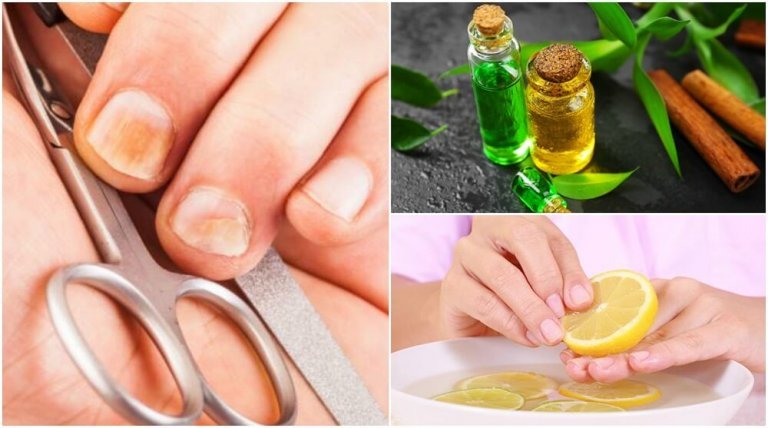5 triks for å eliminere neglesopp og styrke neglene dine