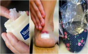 7 tips for å forhindre at skoene dine gir deg gnagsår