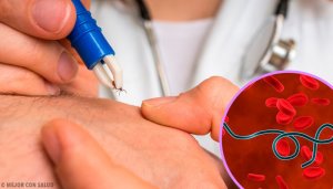 Lyme-sykdom ved flåttbitt: diagnose og behandling