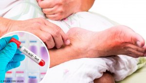 5 vanlige årsaker til høyt nivå av urinsyre