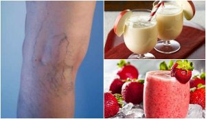 5 hjemmelagde smoothies for å redusere åreknuter