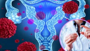 Hva er humant papillomavirus (HPV) og hvordan blir man smittet?