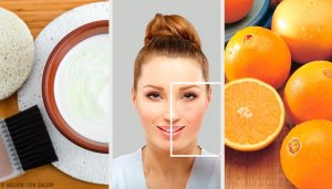 Utrolige naturlige måter å bli kvitt hudflekker på