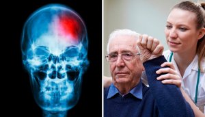 Hva er et drypp? Nøklene til å oppdage det