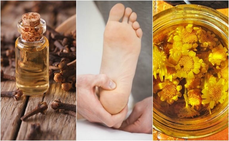 Lindre hælsmerter med 5 naturlige remedier