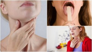 8 tidlige symptomer på strupekreft du ikke må overse