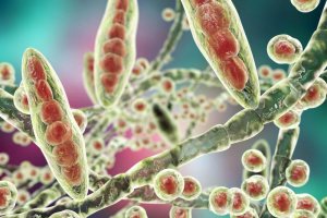 Remedier for å behandle fotsopp - lær hvordan