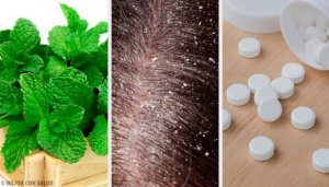 Syv hjemmeremedier for å behandle flass