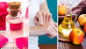 8 naturlige tips for å bleke solflekker på hendene