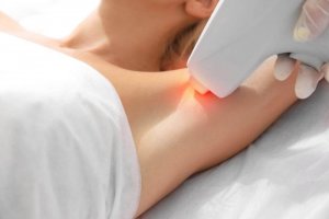 Myter og sannheter om hårfjerning med laser