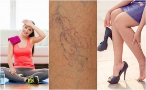 8 ting du kan gjøre for å forhindre spindelvevårer