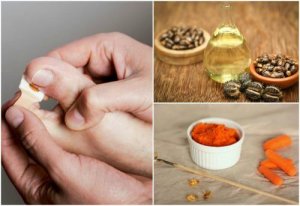 Bli kvitt hengenegler med 8 naturlige behandlinger