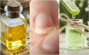 5 naturlige remedier for å fikse svake negler