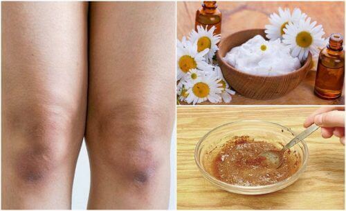 Lysne huden på knærne dine helt naturlig
