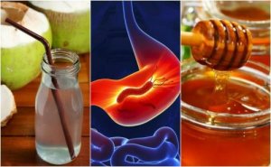 Prøv disse naturlige remediene mot gastritt