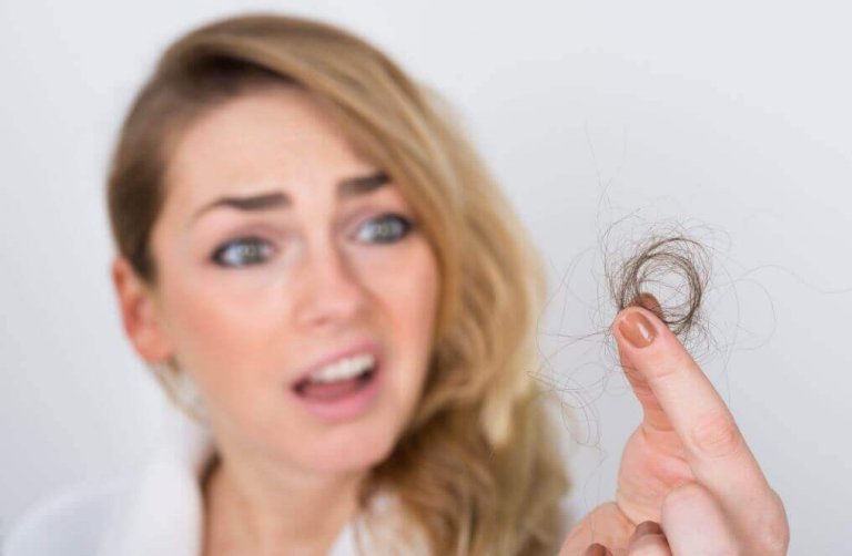Alopecia areata: 7 vanlige myter om hårtap