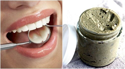 Lær hvordan du kan behandle og forebygge karies 100% naturlig