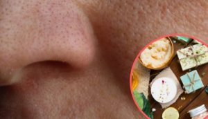 8 hjemmelagede remedier for å forminske store porer