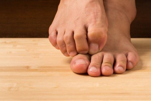 Lær hvordan du kan behandle hudsopp med naturlige ingredienser