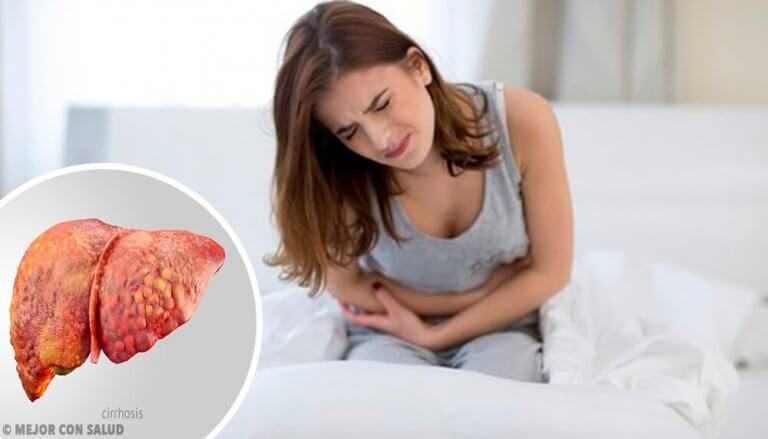 Kvinne med skrumplever