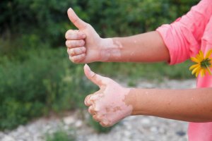 Tillatt og frarådet kosthold i den autoimmune protokollen