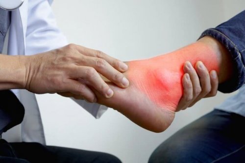 De beste naturlige remediene mot betennelser