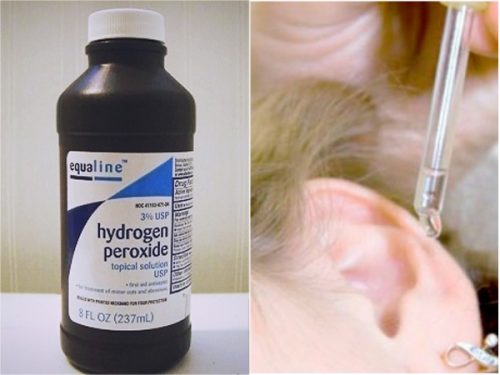 Hydrogenperoksid i øret