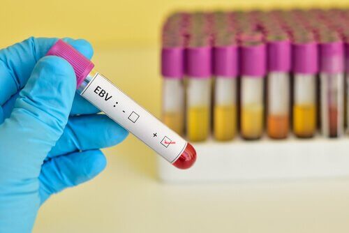 EBV-test