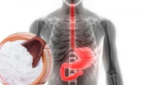 Prøv denne naturlige løsningen mot halsbrann med natron