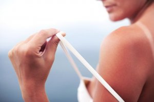 Behandle solbrenthet med disse 5 naturlige metodene