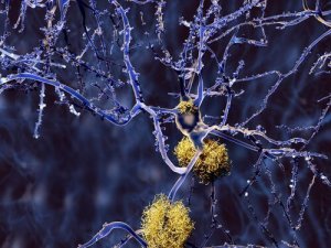 Typer demens som ikke er relatert til Alzheimers sykdom