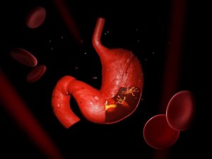 Urtekurer som hjelper mot Helicobacter pylori-infeksjoner